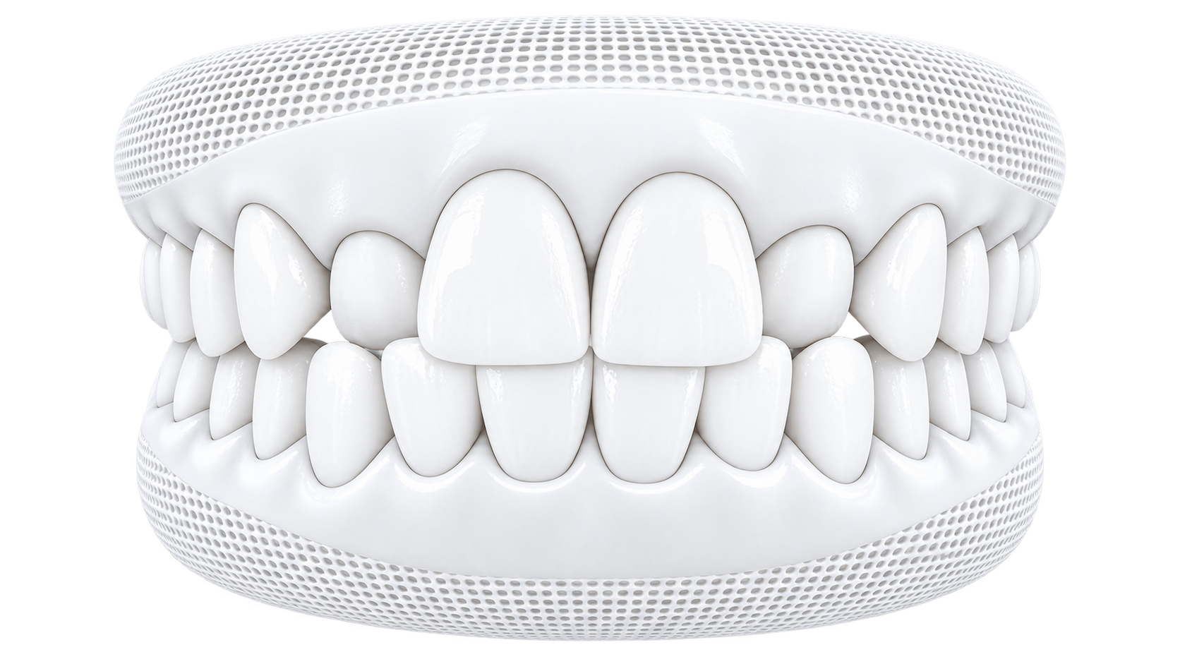 Clear aligner teeth model